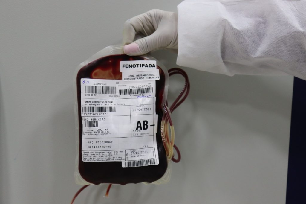 Queda na doação de sangue devido à pandemia preocupa hemocentros 